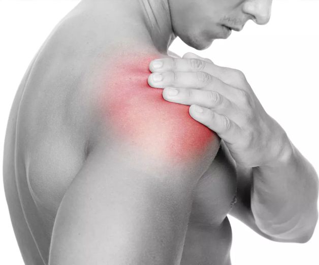 Люди с болью в плече